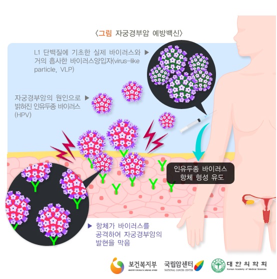 12 자궁경부암 예방백신
